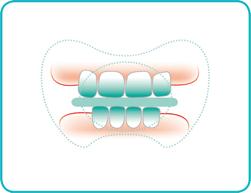 Miss-Denti-579059-344366.jpg