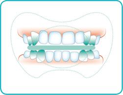 Miss-Denti-579059-456509.jpg